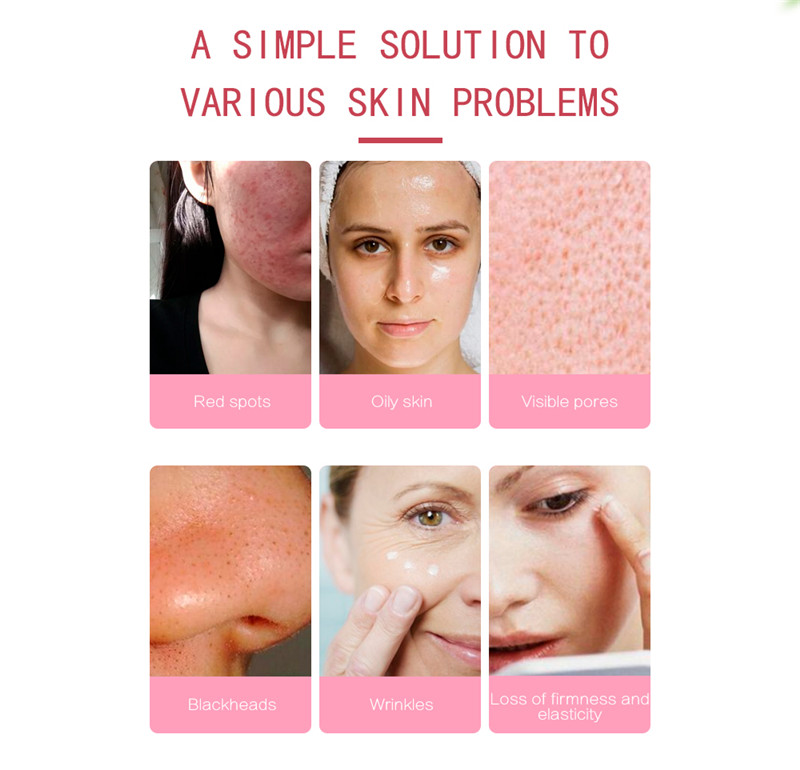 K-SKIN KD8070 electric ultrasonic facial skin scrubber K-SKIN KD8070 electric ultrasonic facial skin scrubber