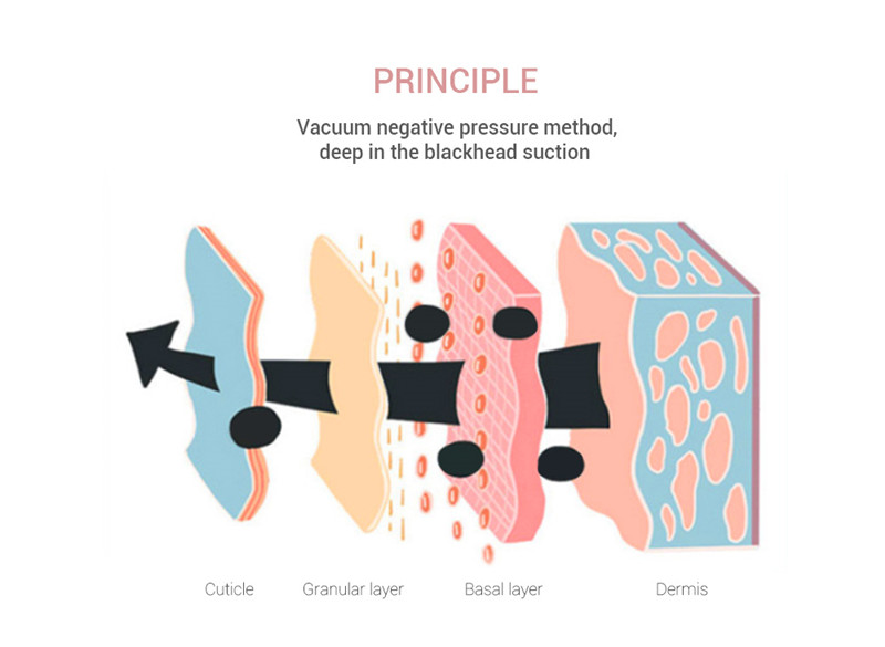 K-SKIN KD803A vacuum suction blackhead remover pore facial cleaner K-SKIN KD803A vacuum suction blackhead remover pore facial cleaner