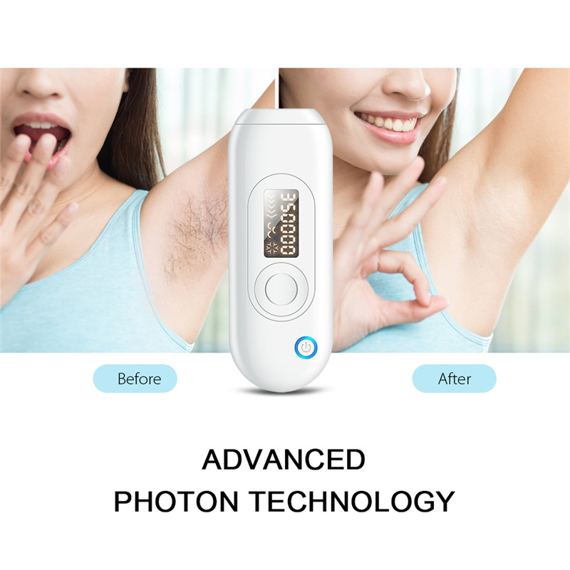K_SKIN KD503A Household Photon Hair Removal Instrument K_SKIN KD503A Household Photon Hair Removal Instrument