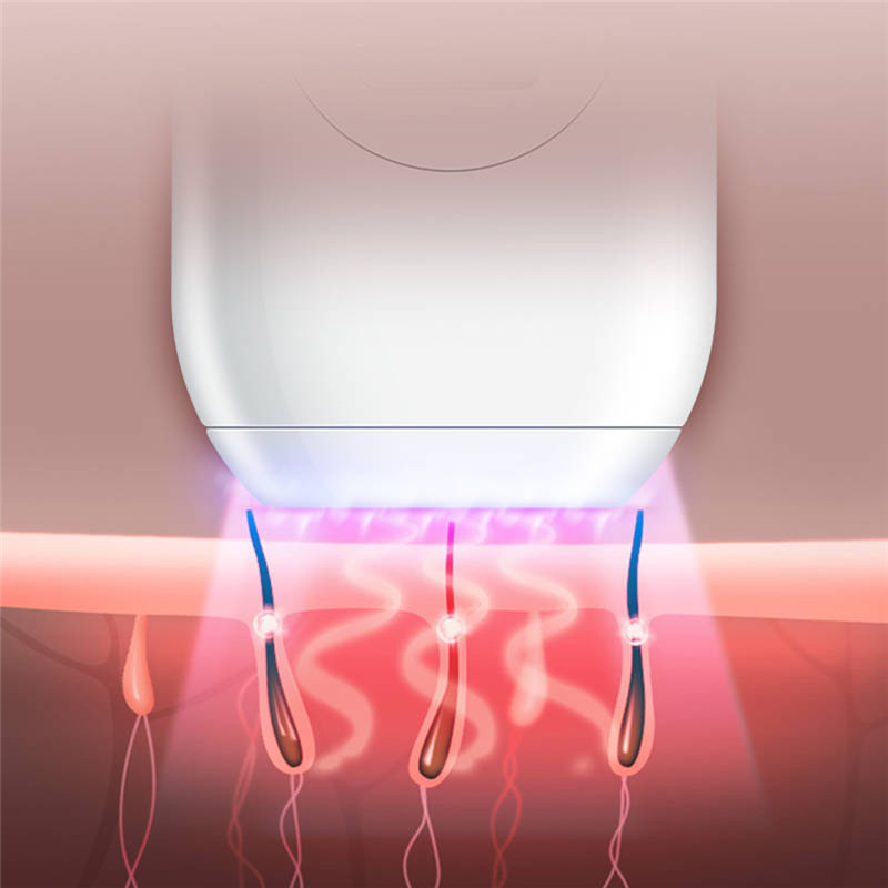 K_SKIN KD503A Household Photon Hair Removal Instrument K_SKIN KD503A Household Photon Hair Removal Instrument